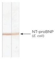Anti-proBNP, clone 15F11