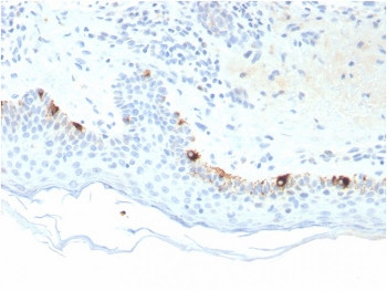 Anti-TRP1 / Tyrosinase-Related Protein-1, clone TYRP1/3281