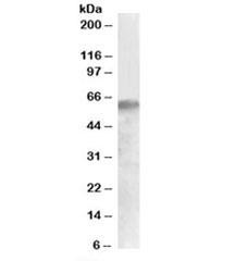 Anti-IRF2BP1