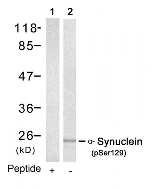 Anti-phospho-alpha Synuclein (Ser129)