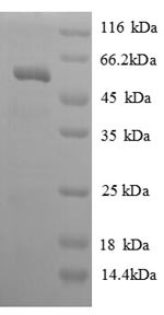 Kallikrein-7 (KLK7), partial, human, recombinant