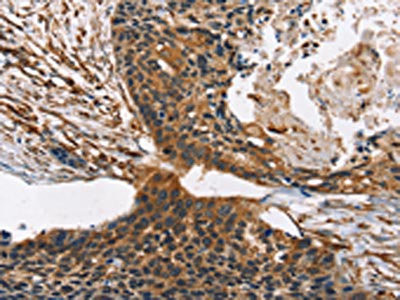 Anti-CNGA1