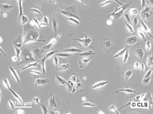 RCC-FG1 Cells