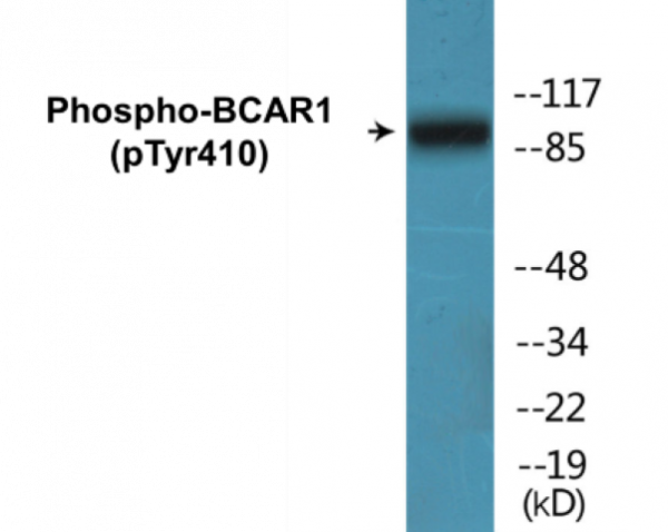 BCAR1 (Phospho-Tyr410) Colorimetric Cell-Based ELISA Kit