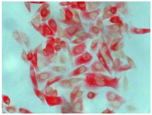 Anti-Cytokeratin 8, clone SB37b