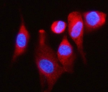 Anti-DAP5 / EIF4G2 / Death-associated protein 5