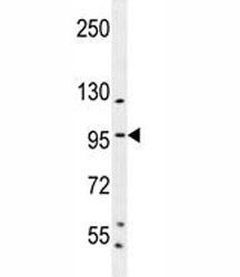 Anti-Specificity Protein 1 Antibody (SP1)