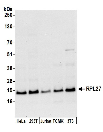 Anti-RPL27/Ribosomal Protein L27