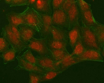 Anti-NUDT15 / Nudix hydrolase 15