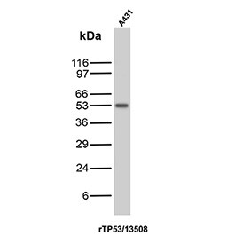 Anti-p53 / TP53, clone rIMX25