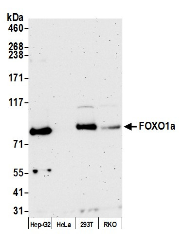 Anti-FOXO1a