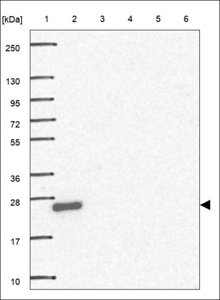 Anti-ROPN1B