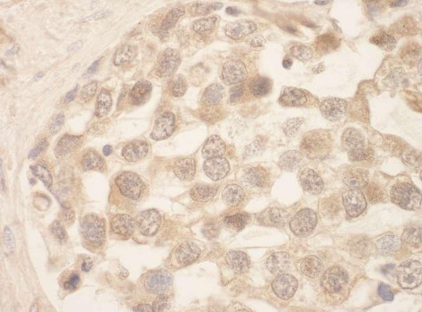 Anti-SRPK1 (IHC)