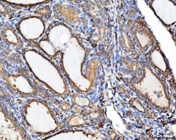 Anti-CHM / Choroideremia protein
