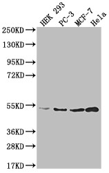 Anti-AHCY Recombinant Monoclonal, clone 13H8