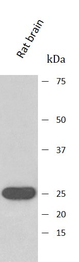 Anti-SOD2