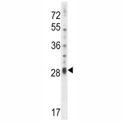 Anti-IL17D