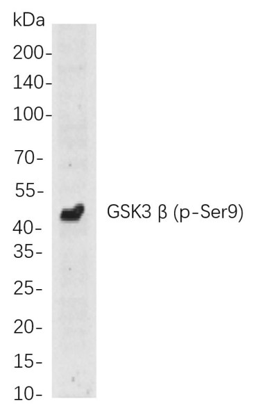 Anti-Recombinant Phospho-GSK3 beta (Ser9), clone 8D9