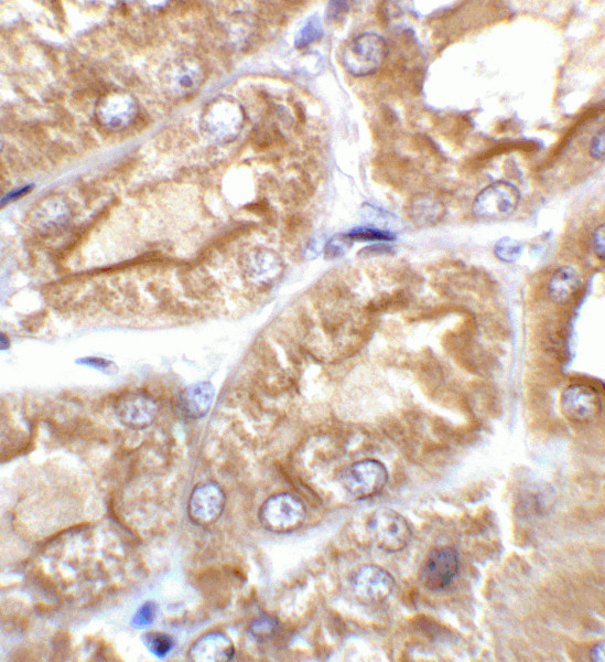 Anti-TRPV4