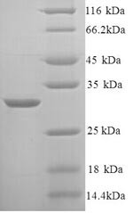 Kininogen-1 (Kng1), partial, rat, recombinant