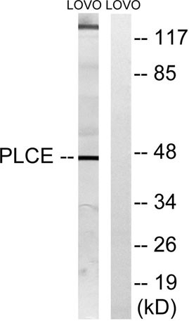 Anti-LPAAT-epsilon