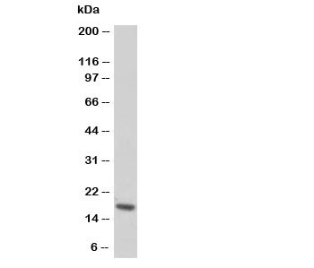 Anti-Troponin C (cardiac)