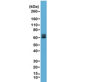 Anti-Paxillin, clone RM256