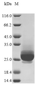 Entry-fusion complex associated protein OPG095 (OPG099), partial, Vaccinia virus, recombinant