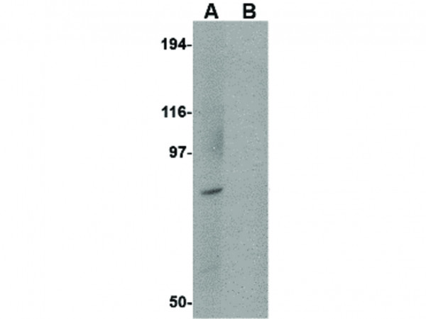 Anti-BICD1