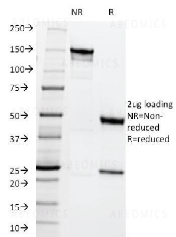 Anti-MRP1 / ABCC1 (Multidrµg Resistance Related Protein 1) Monoclonal Antibody (Clone: MRP1/1344)