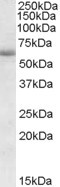 Anti-CDH23 / USH1D, Internal
