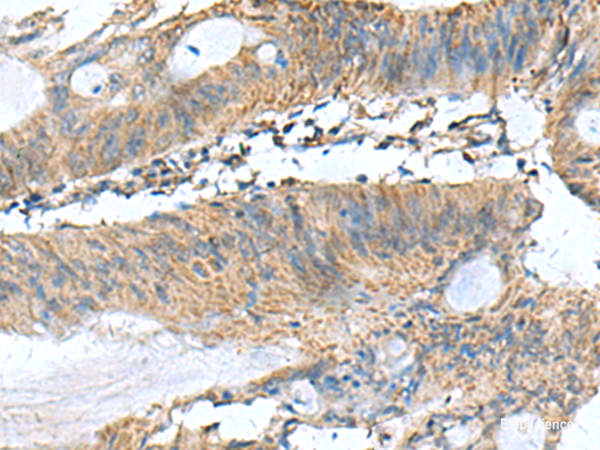 Anti-PAFAH1B3