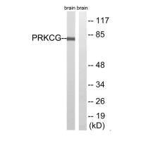 Anti-PRKCG (Ab-655)