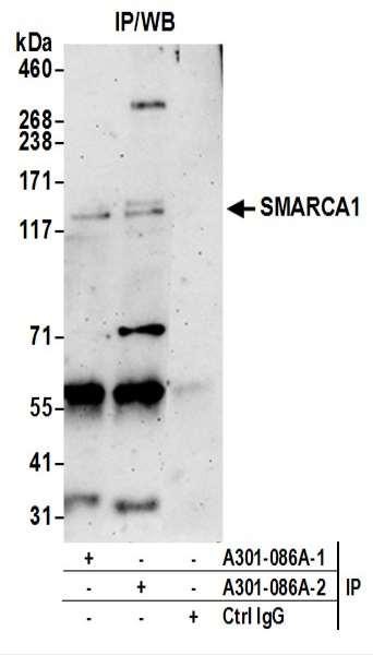 Anti-SMARCA1/SNF2L
