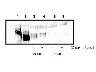 Anti-PKR-like Endoplasmic Reticulum Kinase (PERK)