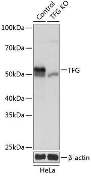 Anti-TRK fused gene (TFG) [KO Validated]
