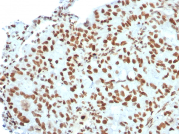 Anti-BMI1 (Oncogene and Stem Cell Marker), clone BMI1/2823