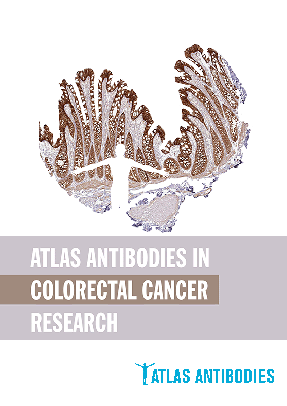 Atlas Antibodies in Colorectal Cancer Research