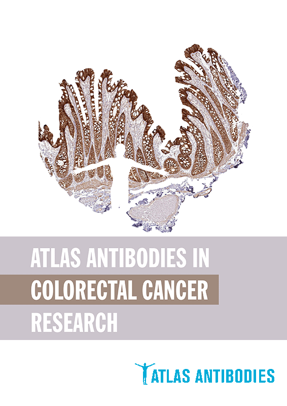 Atlas Antibodies Catalogs Resources Biomol GmbH Life Science Shop
