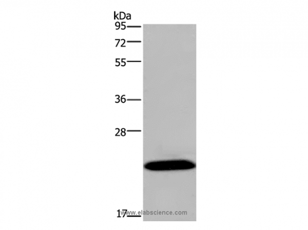 Anti-KCNMB4