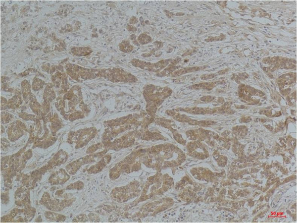 Anti-alpha-Tubulin (acetyl K40)