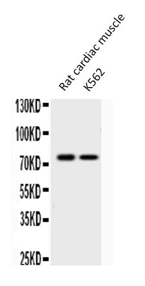 Anti-KCNQ1