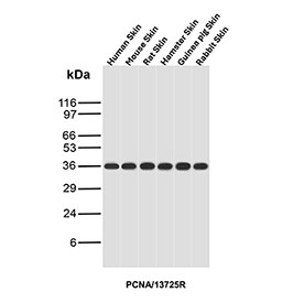 Anti-PCNA / Proliferating cell nuclear antigen, clone PCNA/13725R