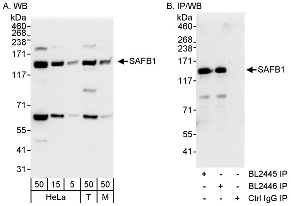 Anti-SAFB1