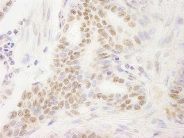 Anti-DEK (IHC)