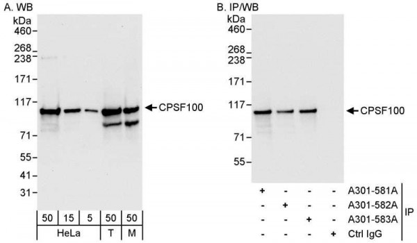 Anti-CPSF100