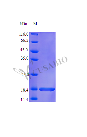 Fibroblast growth factor 10 protein (FGF10), partial (Active), human, recombinant