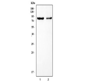 Anti-ATR / Anthrax toxin receptor / TEM8