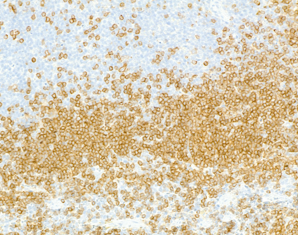 Anti-CD79A Recombinant Monoclonal