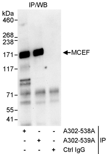 Anti-MCEF